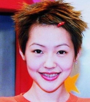 演员孙菲菲坦诚面对整容失败